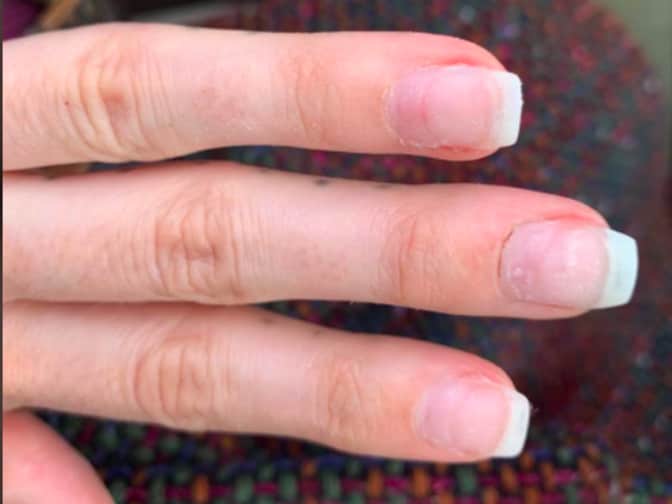 Photo of nails and cuticles before using Egyptian Magic